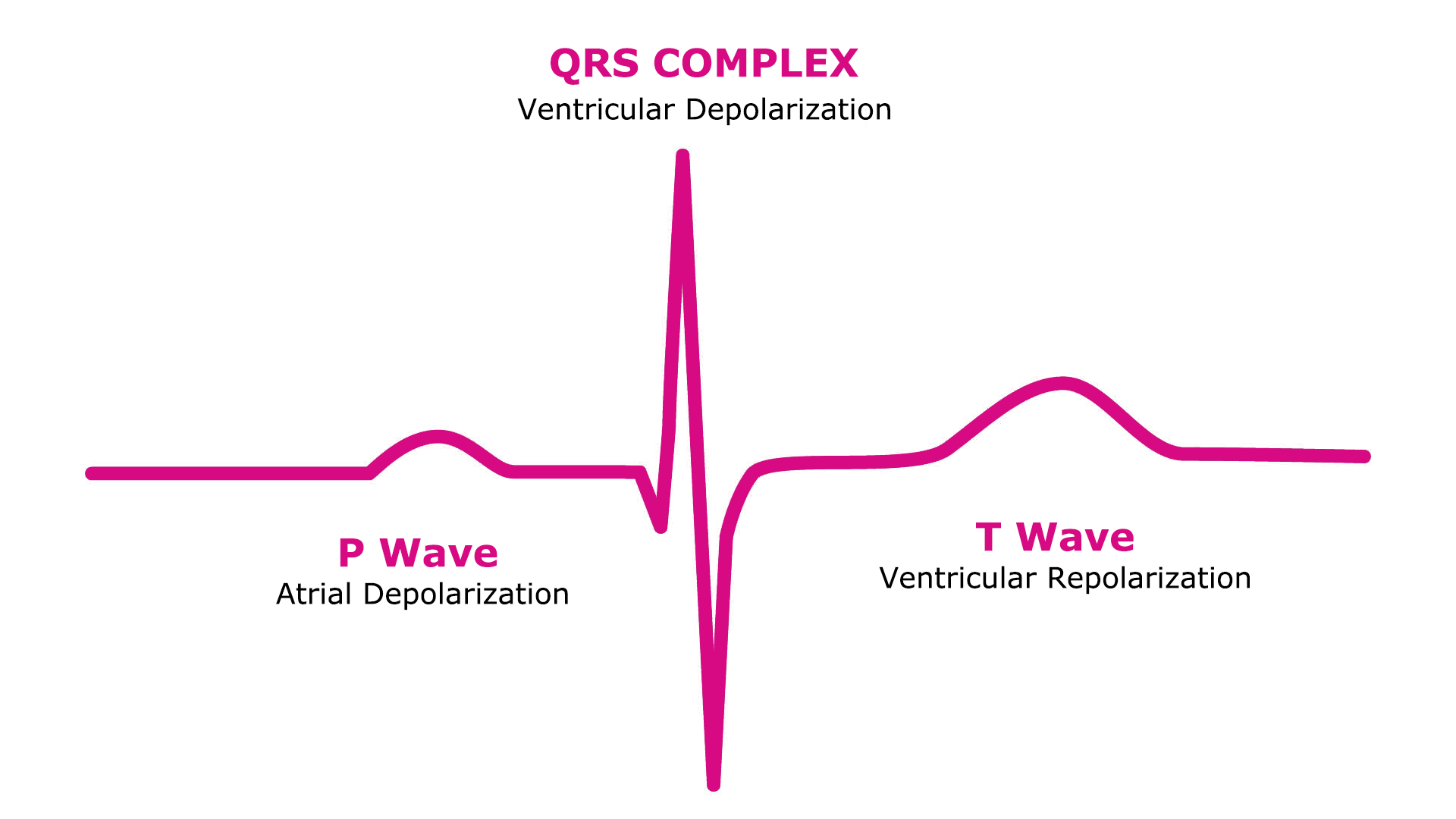 ECG waveform
