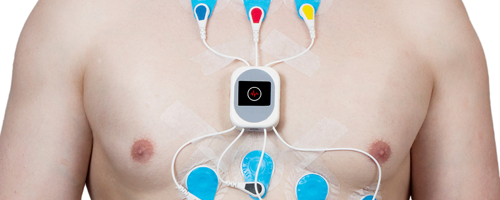 Holter Monitoring