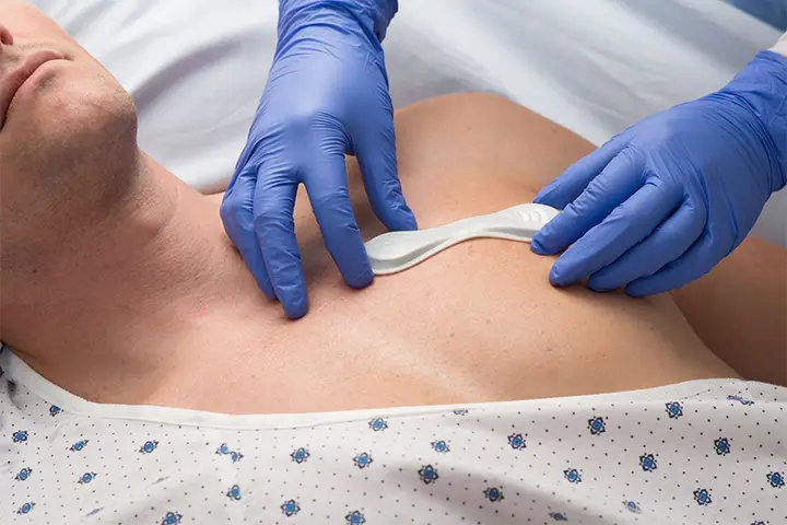 Medical wearable patches Smaller, lightweight and wireless medical patches are more cost efficient comparing to wired medical devices